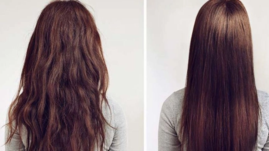 پروتئین تراپی